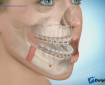 behandlung10-e1461613672583